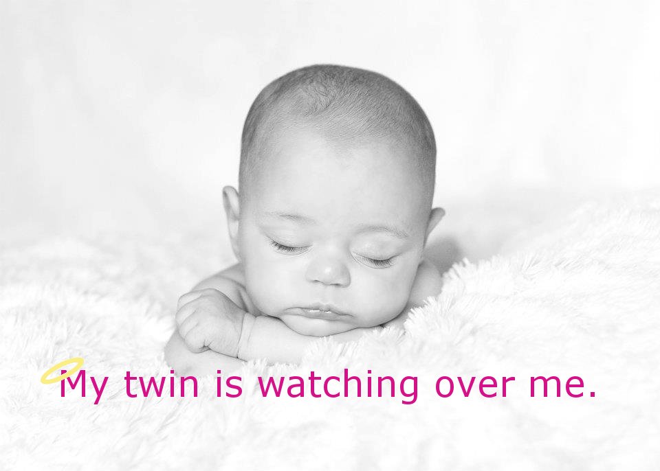 TTTS Twinless Twin