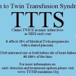Were your TTTS babies preemies? {TTTS Tuesday}