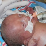 Are You At Risk for Preterm Birth? World Prematurity Day